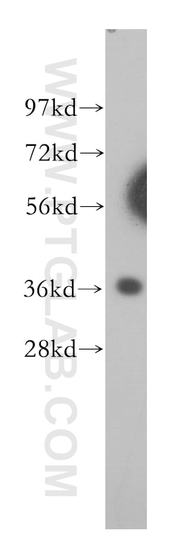 Western Blot (WB) analysis of Jurkat cells using CPOX Polyclonal antibody (12211-1-AP)