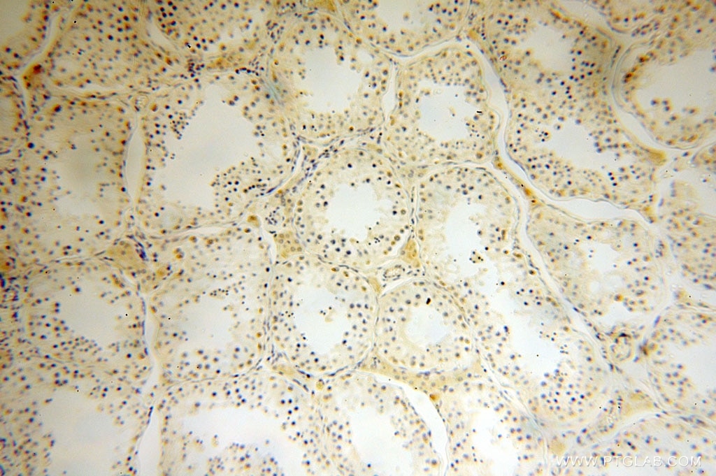 Immunohistochemistry (IHC) staining of human testis tissue using CPOX Polyclonal antibody (16724-1-AP)