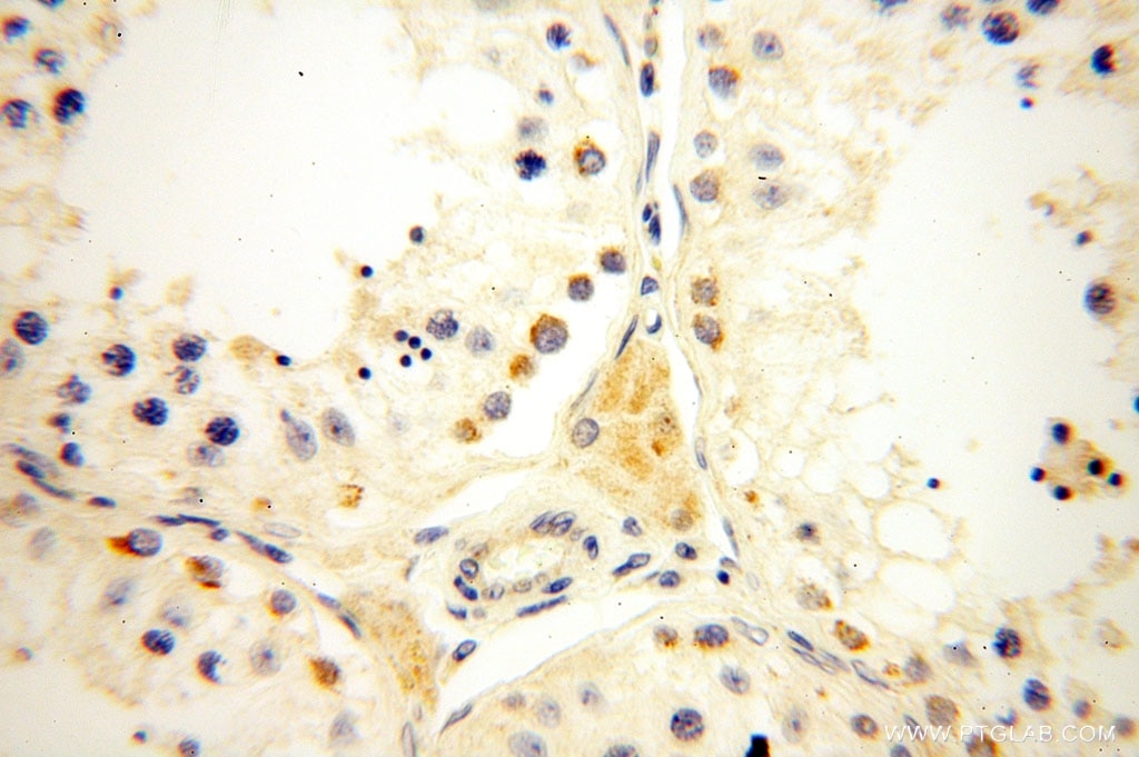 IHC staining of human testis using 16724-1-AP