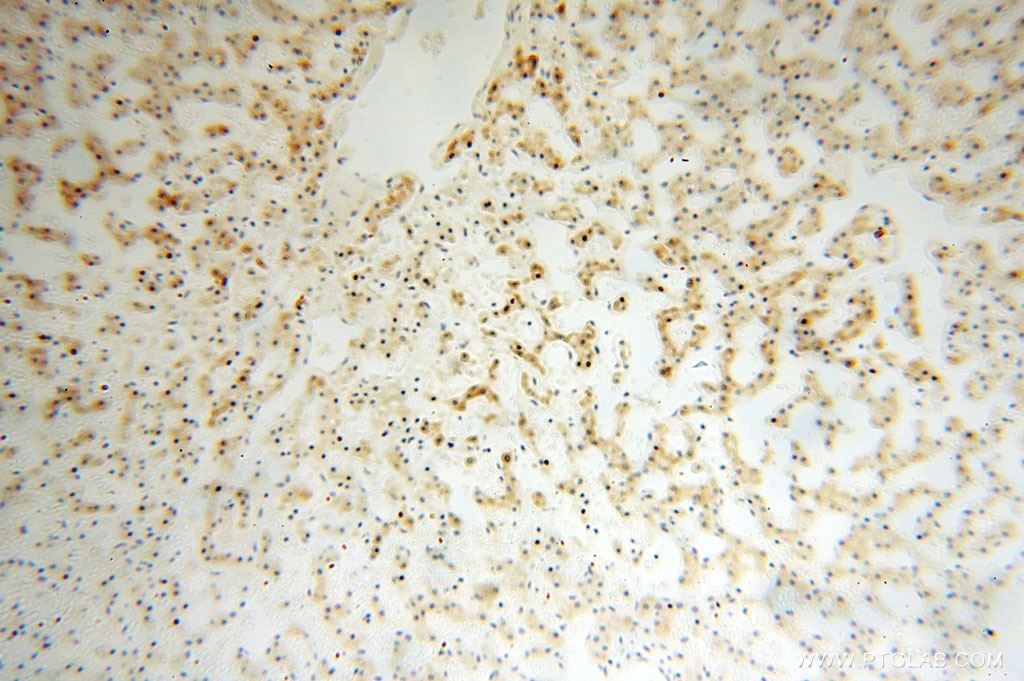 Immunohistochemistry (IHC) staining of human liver tissue using CPOX Polyclonal antibody (16724-1-AP)