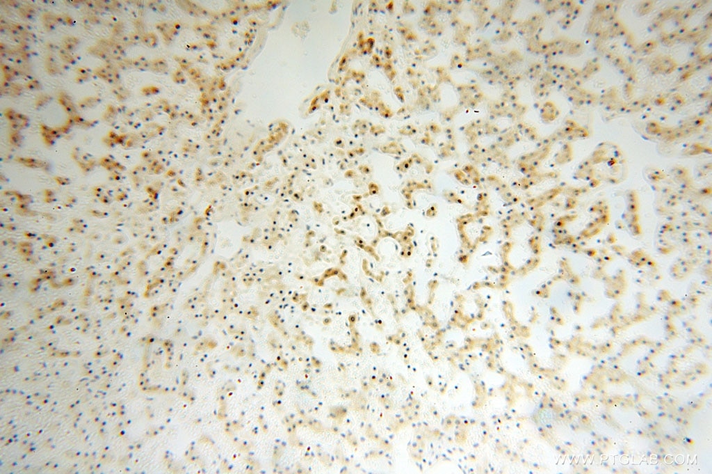 Immunohistochemistry (IHC) staining of human liver tissue using CPOX Polyclonal antibody (16724-1-AP)