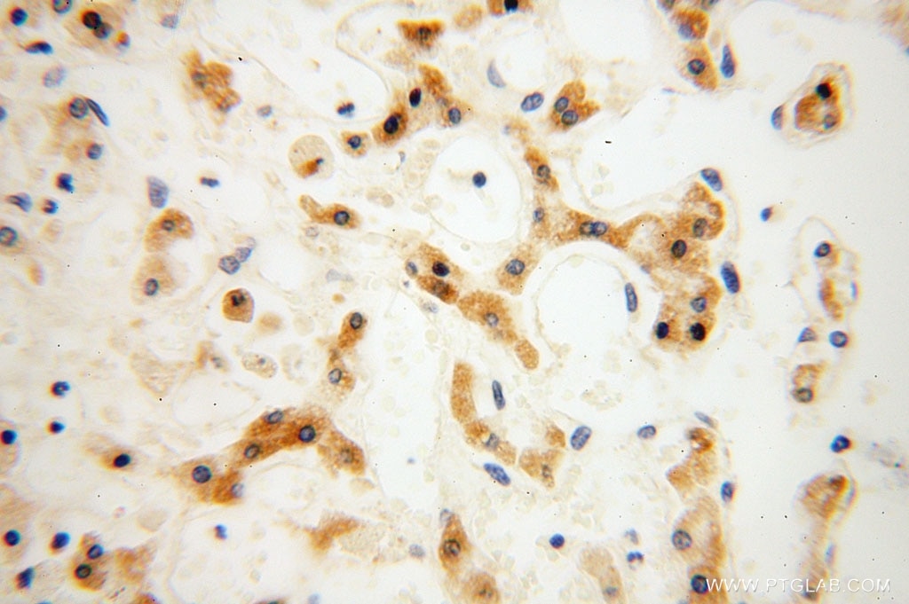 Immunohistochemistry (IHC) staining of human liver tissue using CPOX Polyclonal antibody (16724-1-AP)
