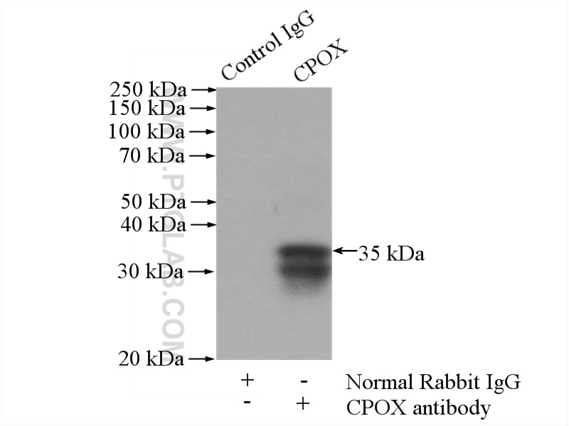 Immunoprecipitation (IP) experiment of HepG2 cells using CPOX Polyclonal antibody (16724-1-AP)