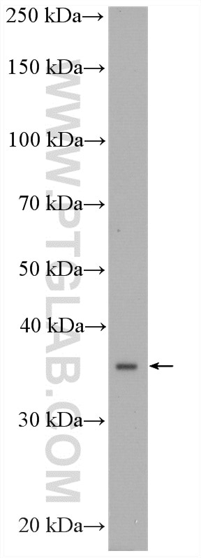 WB analysis of rat liver using 16724-1-AP