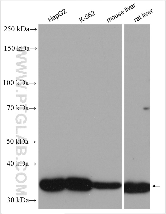 Western Blot (WB) analysis of various lysates using CPOX Polyclonal antibody (16724-1-AP)