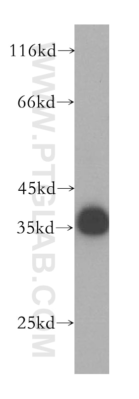 Western Blot (WB) analysis of human liver tissue using CPOX Polyclonal antibody (16724-1-AP)
