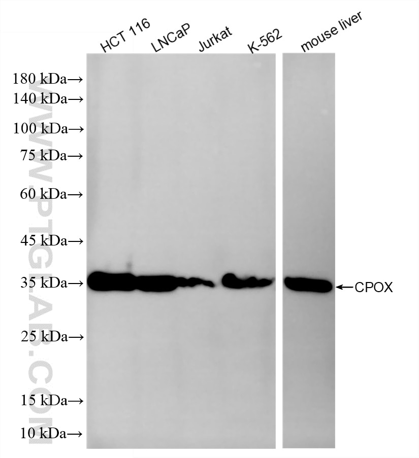 WB analysis using 87270-2-RR (same clone as 87270-2-PBS) Western Blot (WB) analysis of various lysates using CPOX Recombinant monoclonal antibody (87270-2-RR)