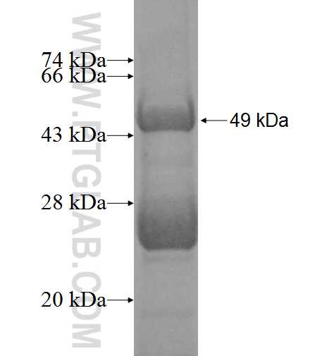 CPOX fusion protein Ag2858 SDS-PAGE