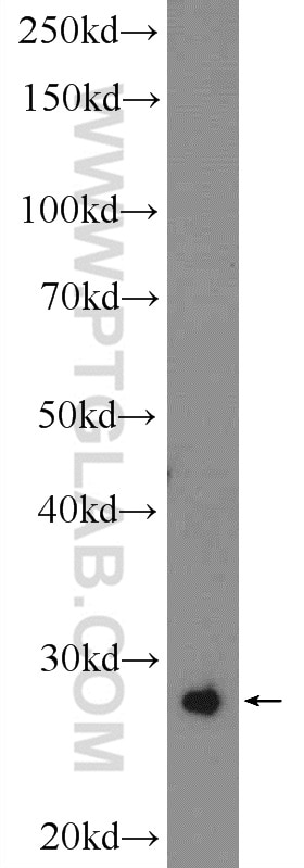 WB analysis of SMMC-7721 using 20628-1-AP