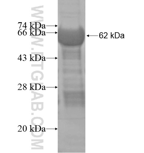 CPPED1 fusion protein Ag14572 SDS-PAGE