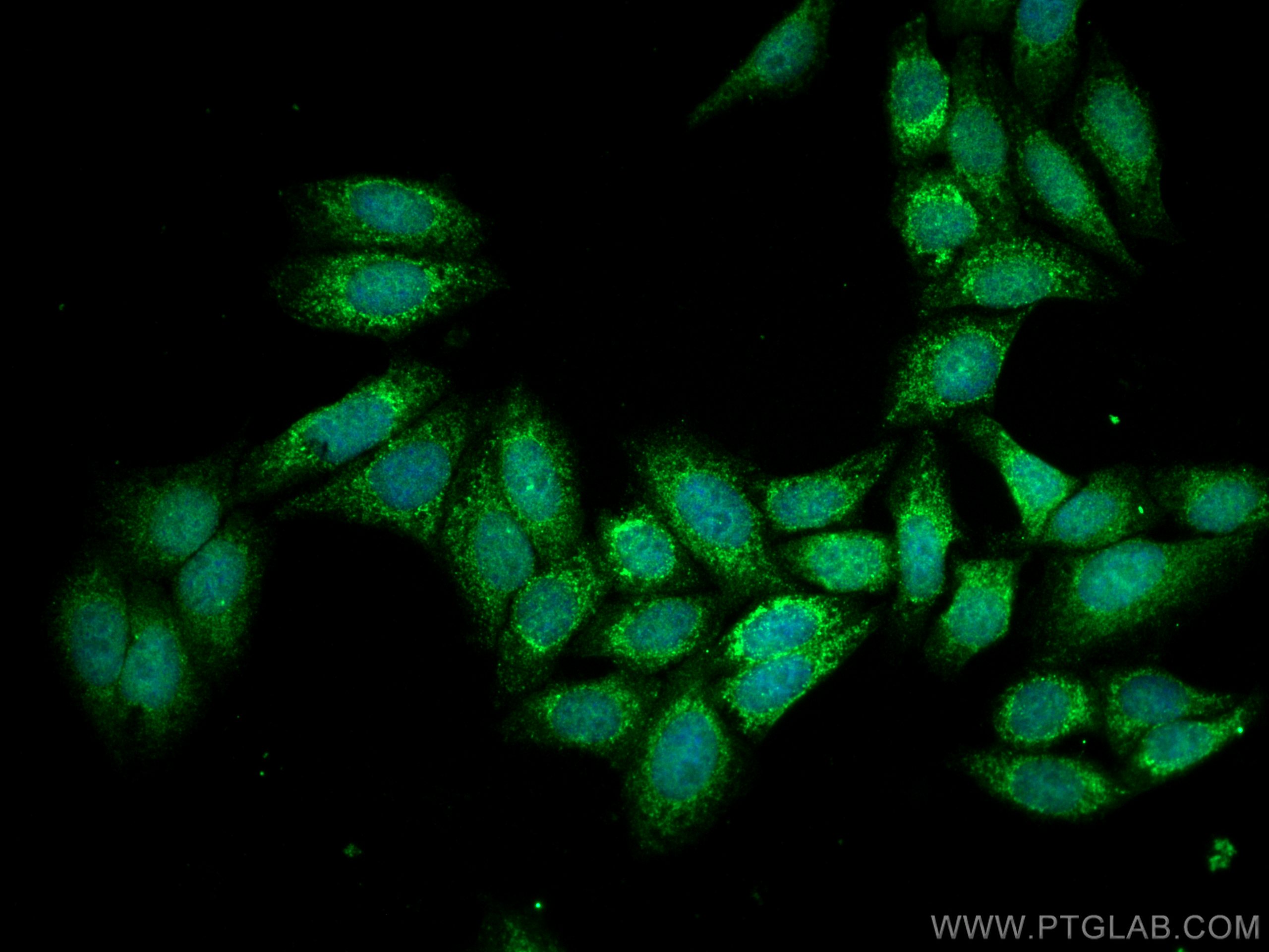 IF Staining of HepG2 using 18703-1-AP