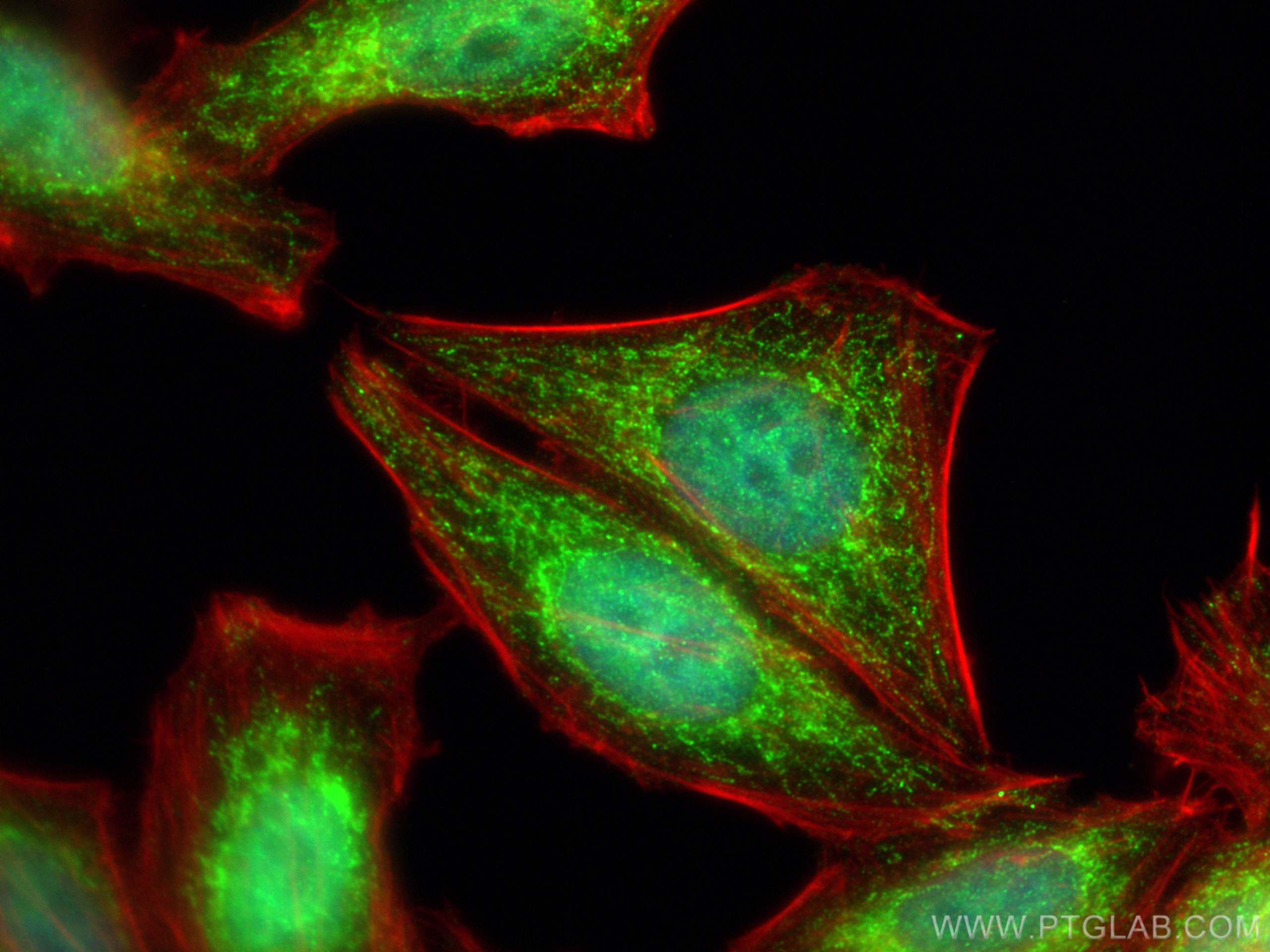 Immunofluorescence (IF) / fluorescent staining of HepG2 cells using CPS1 Polyclonal antibody (18703-1-AP)