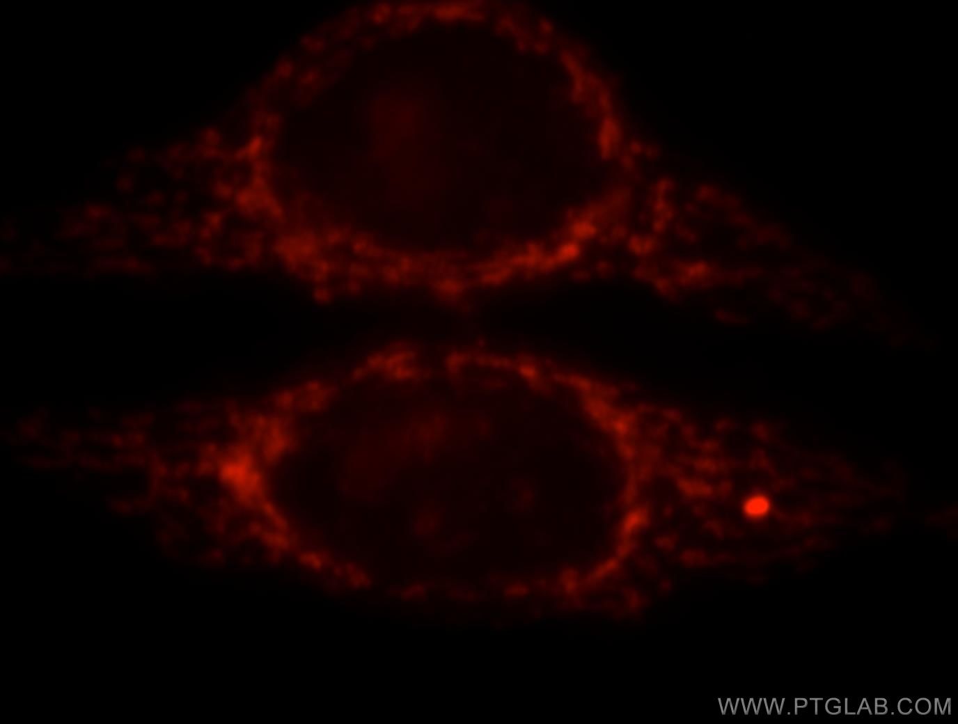 CPS1 Polyclonal antibody