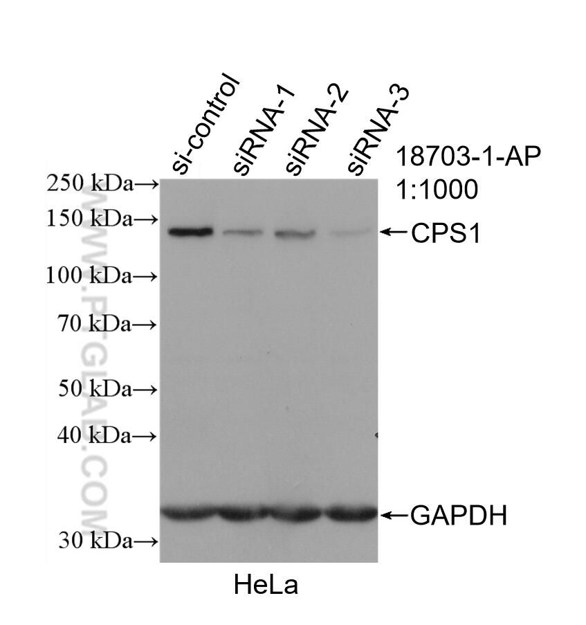 Western Blot (WB) analysis of HeLa cells using CPS1 Polyclonal antibody (18703-1-AP)