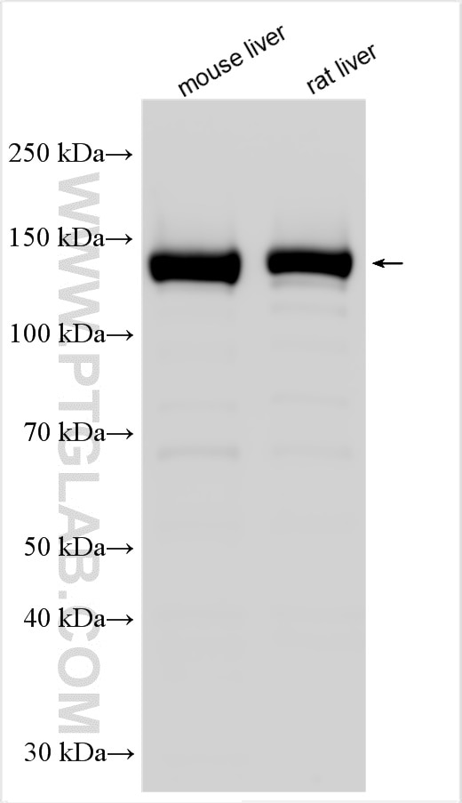 Western Blot (WB) analysis of various lysates using CPS1 Polyclonal antibody (18703-1-AP)