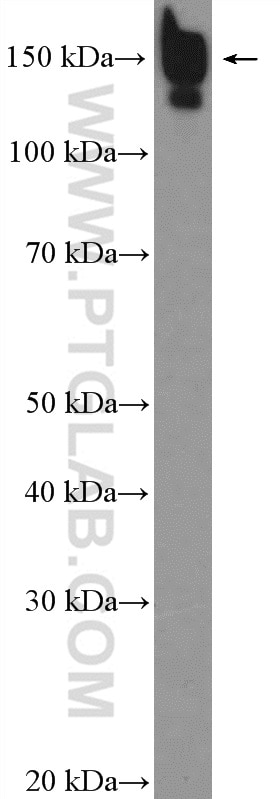 Western Blot (WB) analysis of mouse liver tissue using CPS1 Polyclonal antibody (18703-1-AP)
