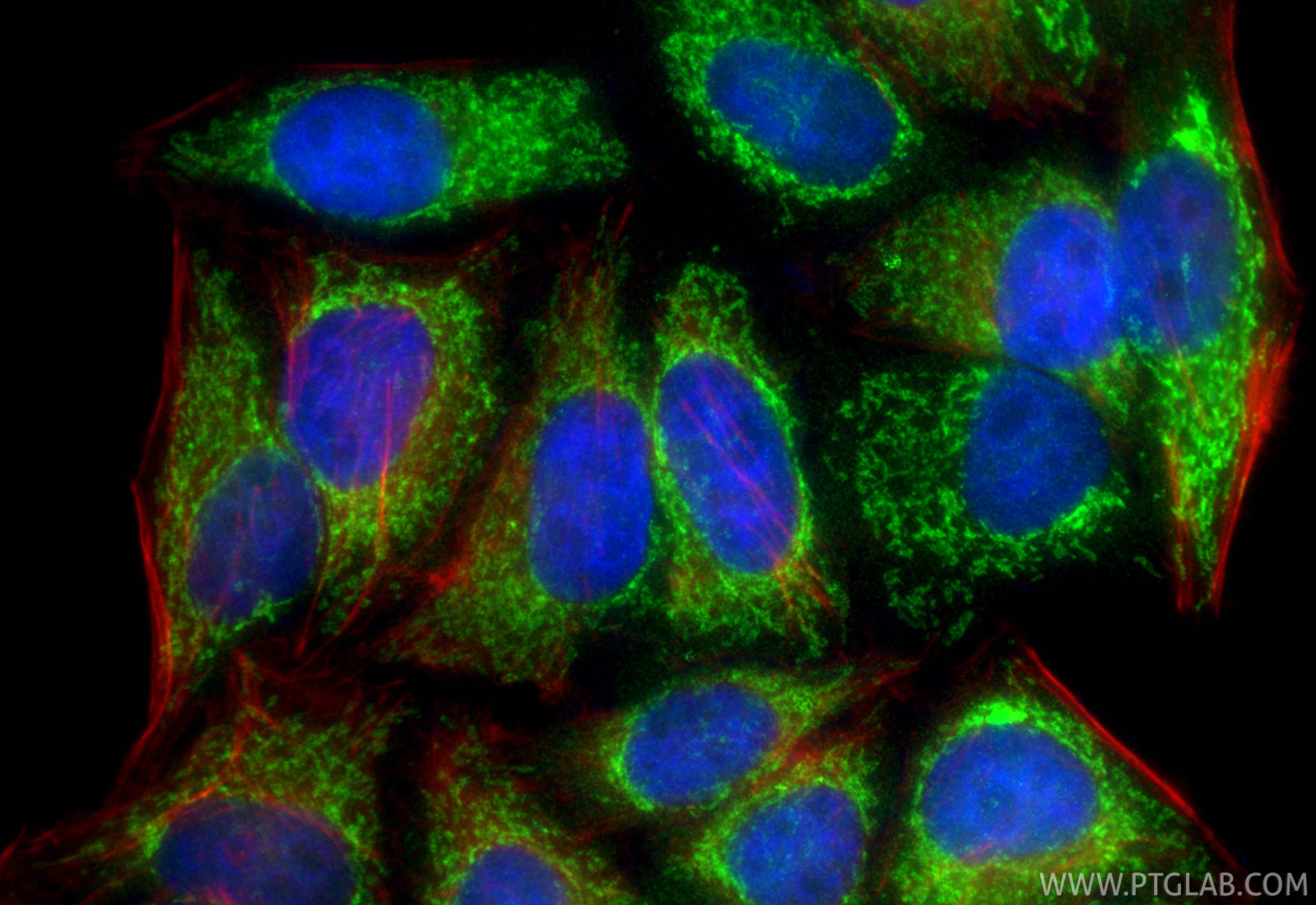 Immunofluorescence (IF) / fluorescent staining of HepG2 cells using CPS1 Polyclonal antibody (24513-1-AP)
