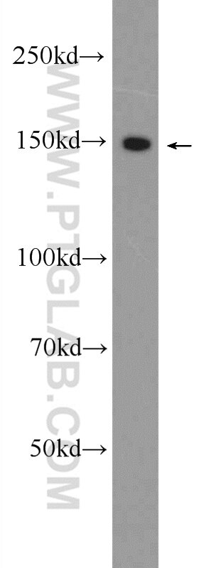 Western Blot (WB) analysis of HepG2 cells using CPS1 Polyclonal antibody (24513-1-AP)