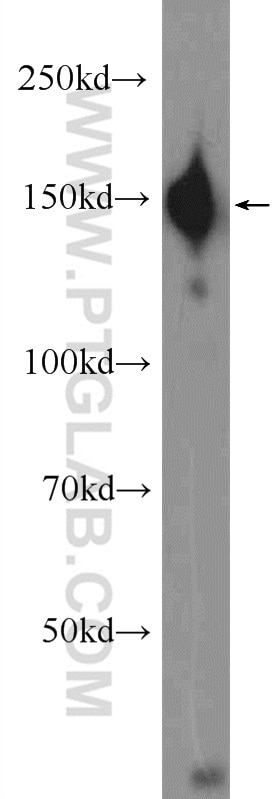 WB analysis of rat liver using 24513-1-AP