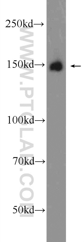 Western Blot (WB) analysis of mouse liver tissue using CPS1 Polyclonal antibody (24513-1-AP)