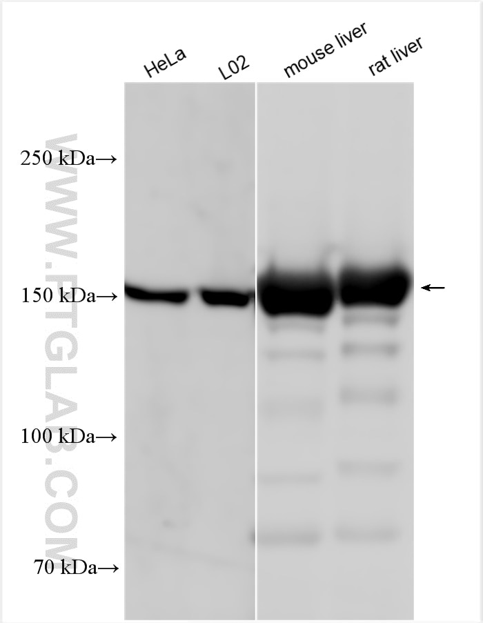 Western Blot (WB) analysis of various lysates using CPS1 Polyclonal antibody (24513-1-AP)