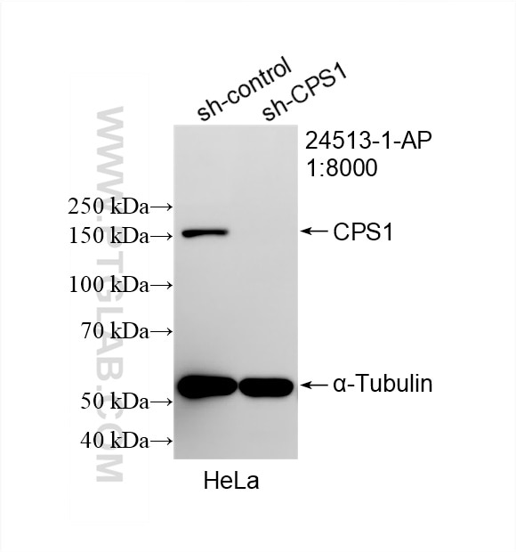 Western Blot (WB) analysis of HeLa cells using CPS1 Polyclonal antibody (24513-1-AP)