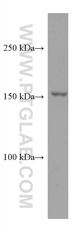 Western Blot (WB) analysis of HeLa cells using CPS1 Monoclonal antibody (67630-1-Ig)
