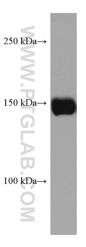 Western Blot (WB) analysis of rat liver tissue using CPS1 Monoclonal antibody (67630-1-Ig)