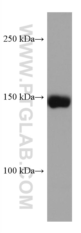 Western Blot (WB) analysis of mouse liver tissue using CPS1 Monoclonal antibody (67630-1-Ig)