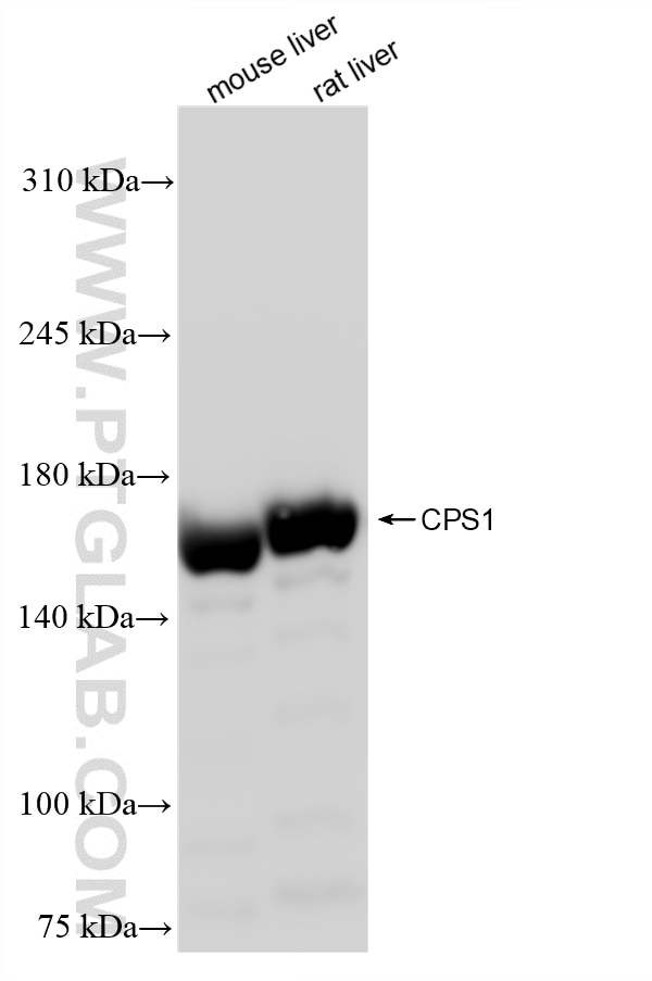 Western Blot (WB) analysis of various lysates using CPS1 Recombinant antibody (84277-1-RR)