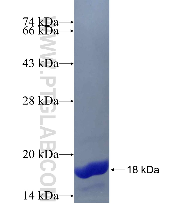 CPS1 fusion protein Ag21605 SDS-PAGE