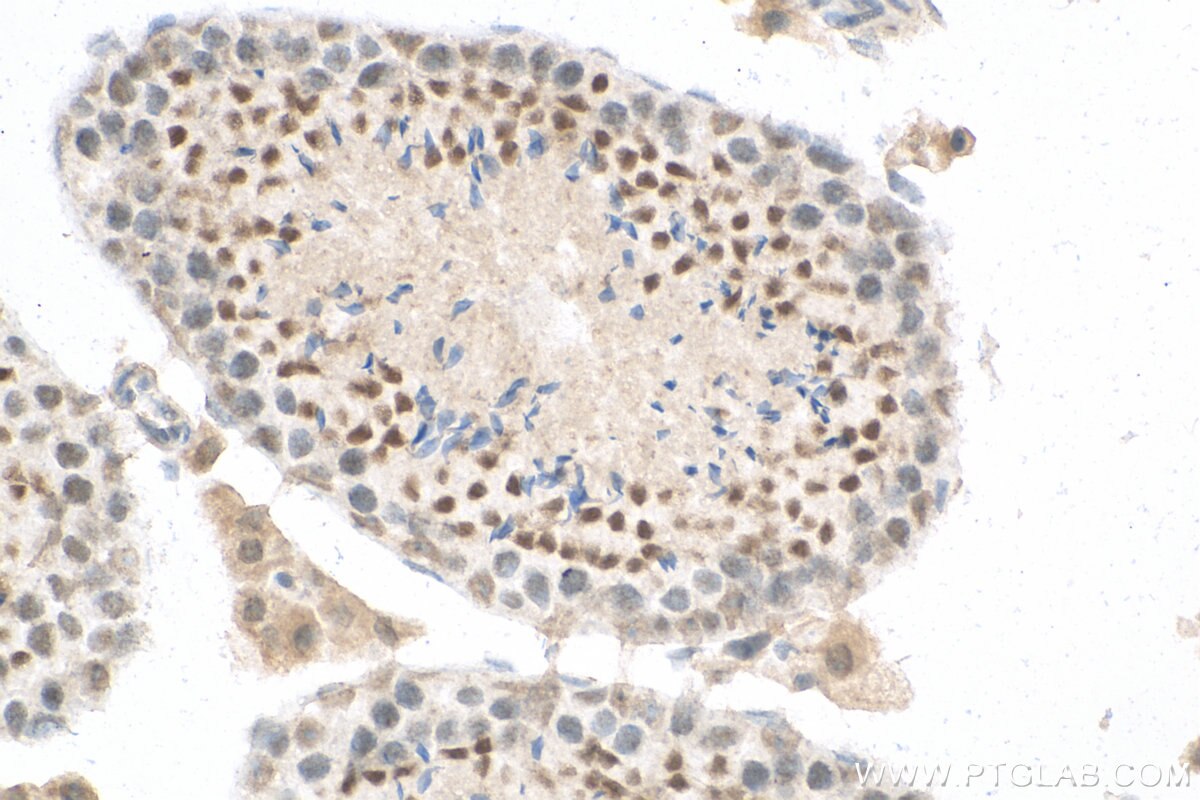 Immunohistochemistry (IHC) staining of mouse testis tissue using CPSF1 Polyclonal antibody (11031-1-AP)