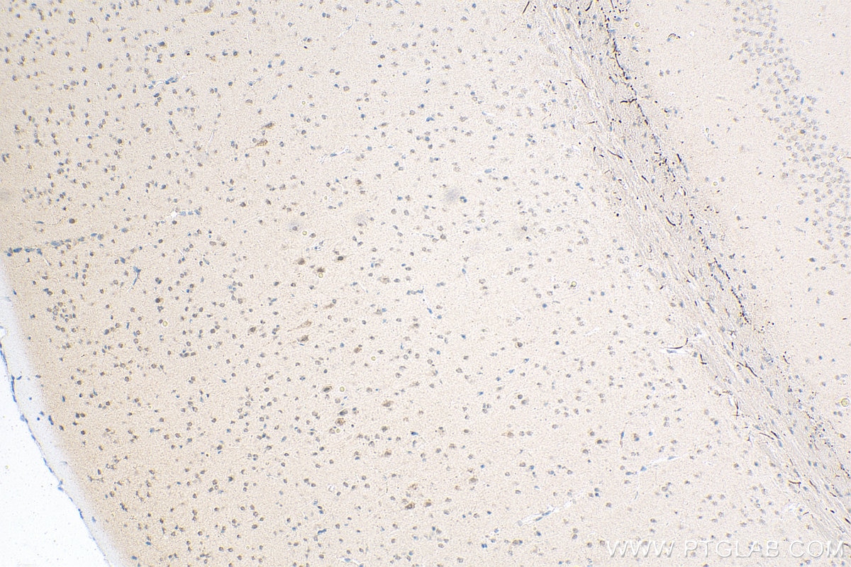 Immunohistochemistry (IHC) staining of mouse brain tissue using CPSF1 Polyclonal antibody (11031-1-AP)