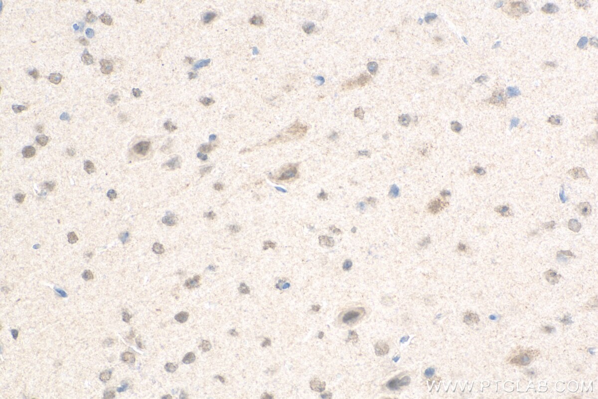 Immunohistochemistry (IHC) staining of mouse brain tissue using CPSF1 Polyclonal antibody (11031-1-AP)