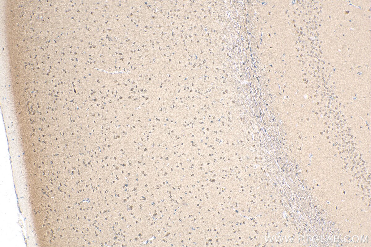 Immunohistochemistry (IHC) staining of mouse brain tissue using CPSF1 Polyclonal antibody (11031-1-AP)