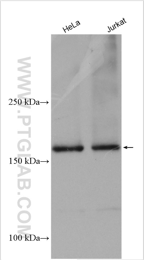 Western Blot (WB) analysis of various lysates using CPSF1 Polyclonal antibody (11031-1-AP)