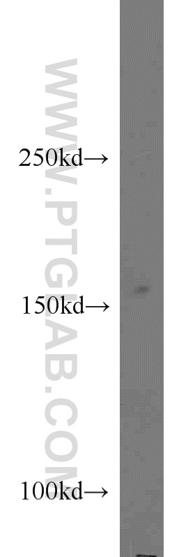 Western Blot (WB) analysis of HeLa cells using CPSF1 Polyclonal antibody (11031-1-AP)