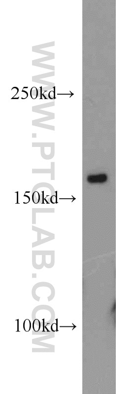 Western Blot (WB) analysis of Jurkat cells using CPSF1 Polyclonal antibody (11031-1-AP)