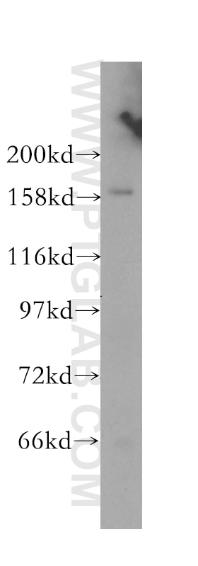 Western Blot (WB) analysis of human brain tissue using CPSF1 Polyclonal antibody (11031-1-AP)