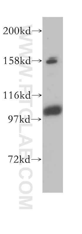 Western Blot (WB) analysis of human brain tissue using CPSF2 Polyclonal antibody (17739-1-AP)