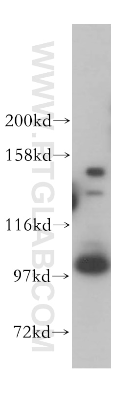 Western Blot (WB) analysis of HeLa cells using CPSF2 Polyclonal antibody (17739-1-AP)