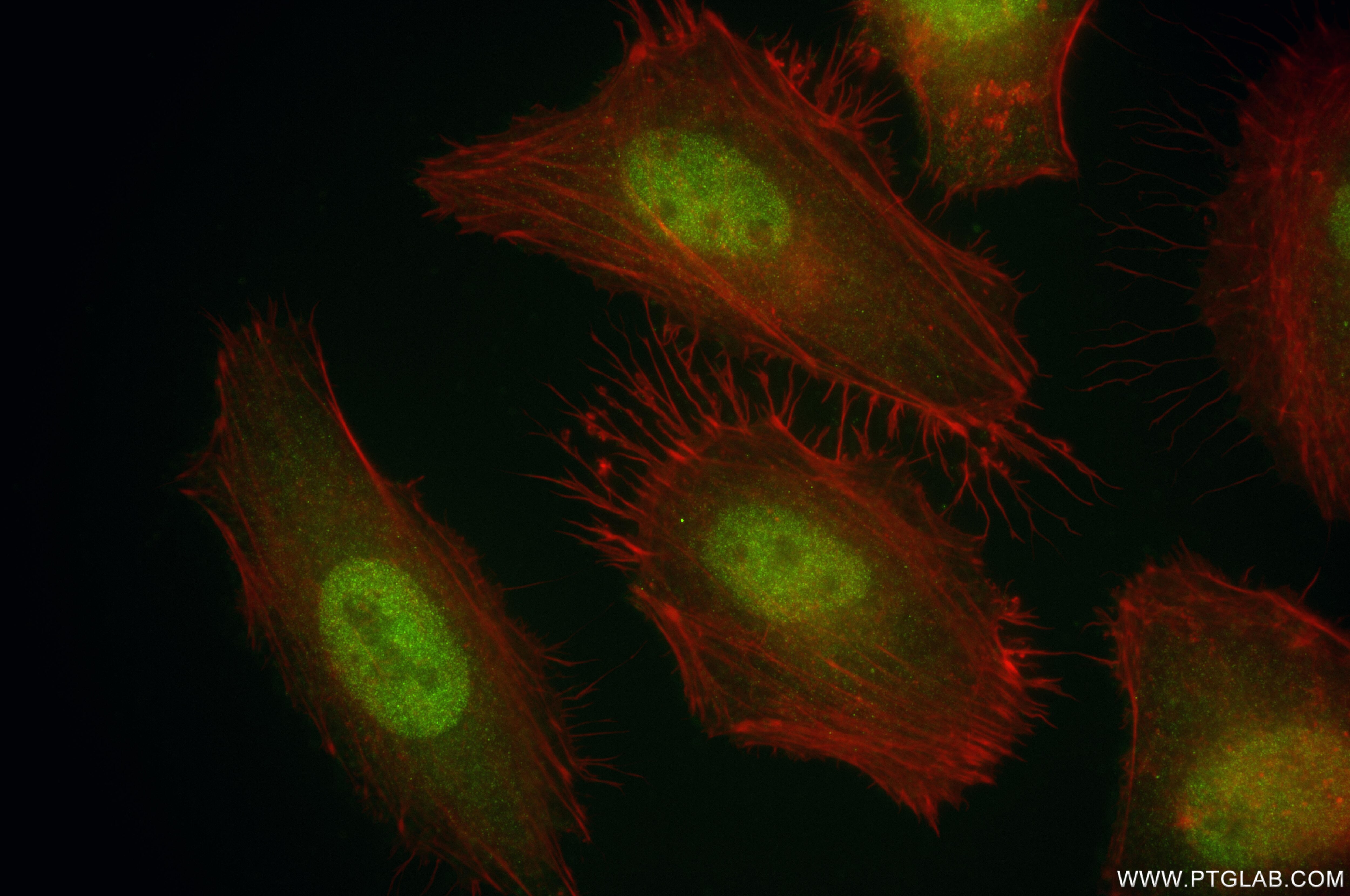 Immunofluorescence (IF) / fluorescent staining of HeLa cells using CPSF2 Recombinant antibody (86513-3-RR)