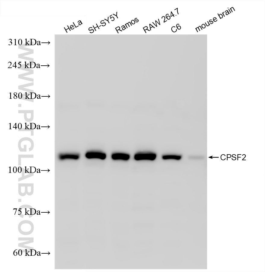 Western Blot (WB) analysis of various lysates using CPSF2 Recombinant antibody (86513-3-RR)