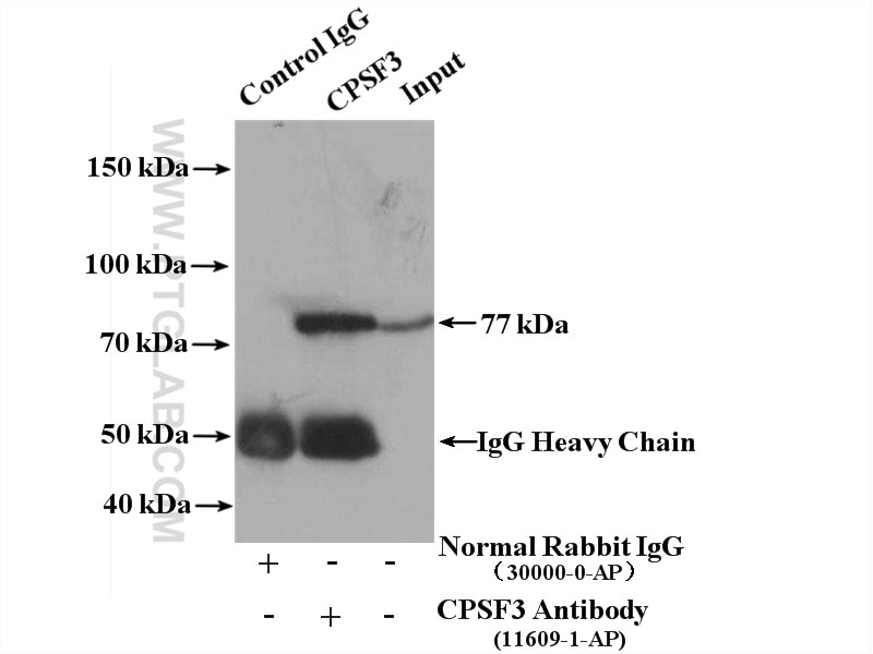 Immunoprecipitation (IP) experiment of HEK-293 cells using CPSF3 Polyclonal antibody (11609-1-AP)