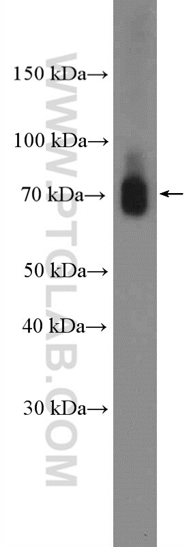 Western Blot (WB) analysis of HEK-293 cells using CPSF3 Polyclonal antibody (11609-1-AP)