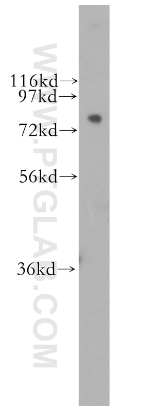 Western Blot (WB) analysis of human skin tissue using CPSF3 Polyclonal antibody (11609-1-AP)