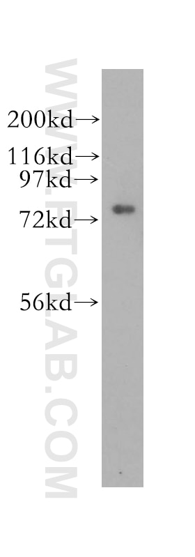 Western Blot (WB) analysis of human brain tissue using CPSF3 Polyclonal antibody (11609-1-AP)