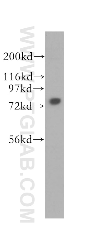 Western Blot (WB) analysis of HepG2 cells using CPSF3 Polyclonal antibody (11609-1-AP)