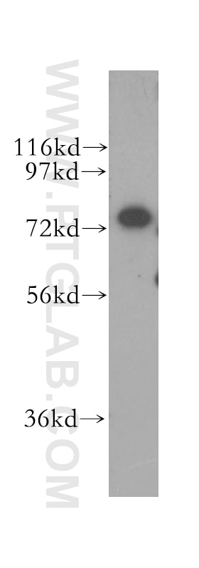 Western Blot (WB) analysis of HEK-293 cells using CPSF3 Polyclonal antibody (11609-1-AP)