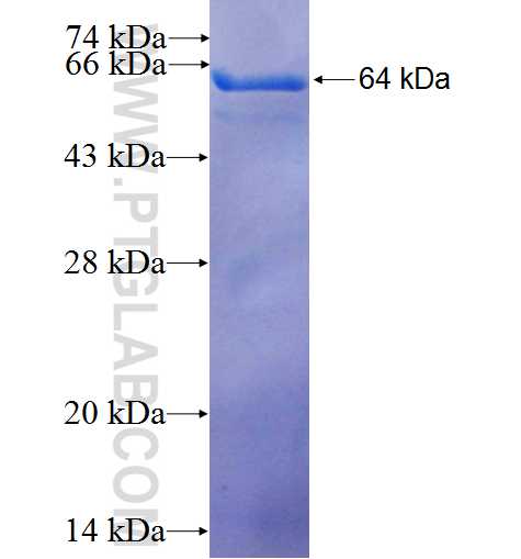 CPSF3 fusion protein Ag2173 SDS-PAGE